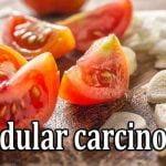 Men's diet: tomatoes use for lower risk of glandular carcinoma