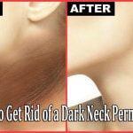 How to Get Rid of a Dark Neck Permanently