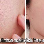 How to Get eliminate massive Skin Pores on Your Skin