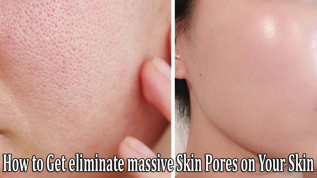 How to Get eliminate massive Skin Pores on Your Skin