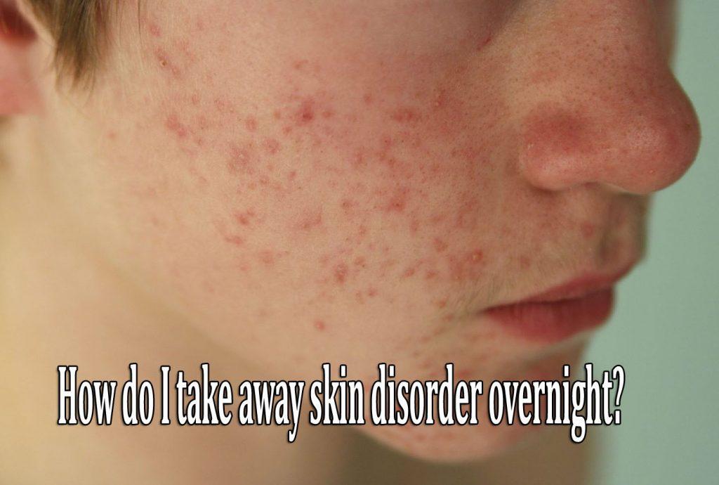 How do I take away skin disorder overnight?