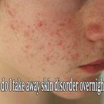 How do I take away skin disorder overnight?