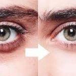 I have very dark circles under my eyes and I tried several creams but none of them worked. What's the best cream in the world?