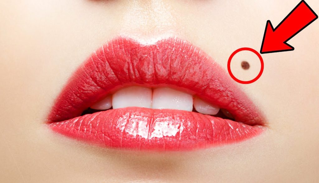 If You Have A Mole At One Of These 7 Places On Your Body, What It Means!